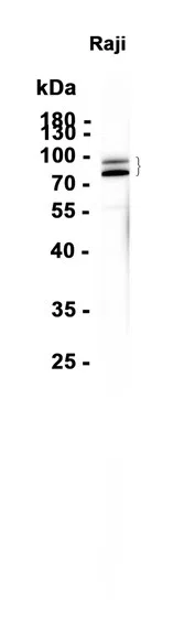 FOXP1 Rabbit Monoclonal Antibody - Size: 50µl