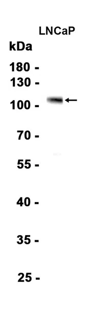 Androgen Receptor Rabbit Monoclonal Antibody - Size: 50µl