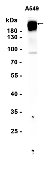 MRP2 Rabbit Monoclonal Antibody - Size: 100µl