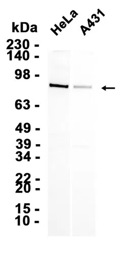Transferrin Receptor Rabbit Monoclonal Antibody - Size: 100µl