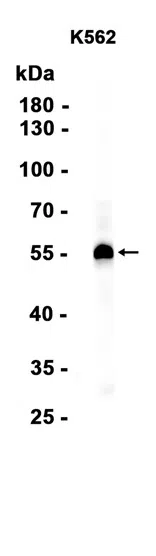 LKB1 Rabbit Monoclonal Antibody