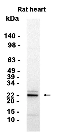 IGF1 Rabbit Monoclonal Antibody