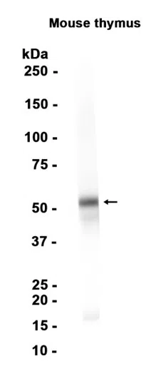 ROR gamma Rabbit Monoclonal Antibody - Size: 50µl
