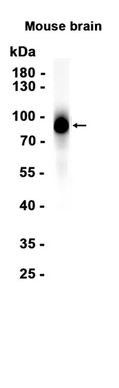 CD39 Rabbit Monoclonal Antibody