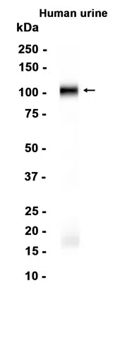 Uromucoid Rabbit Monoclonal Antibody - Size: 100µl