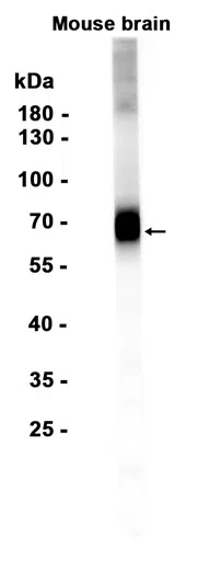 EAAT2 Rabbit Monoclonal Antibody - Size: 50µl