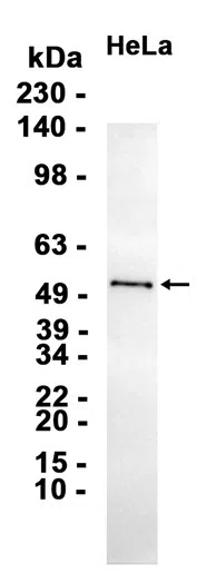 EGR2 Rabbit Monoclonal Antibody - Size: 100µl