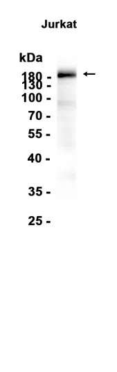 CD45 Rabbit Monoclonal Antibody