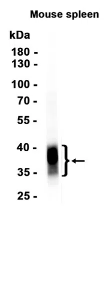 CD8 alpha Rabbit Monoclonal Antibody