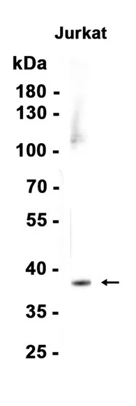 Arg2 Rabbit Monoclonal Antibody - Size: 50µl
