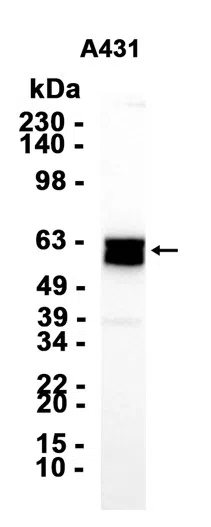 PVRL4 Rabbit Monoclonal Antibody - Size: 50µl