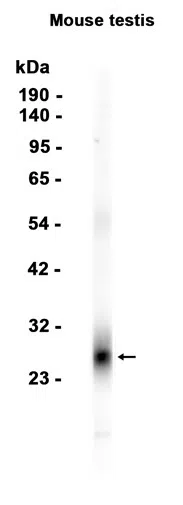 ODF1 Rabbit Monoclonal Antibody