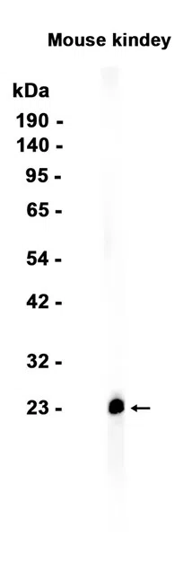 RHOD Rabbit Monoclonal Antibody - Size: 100µl