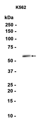 MGAT2 Rabbit Monoclonal Antibody - Size: 100µl