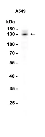 RBM6 Rabbit Monoclonal Antibody - Size: 50µl