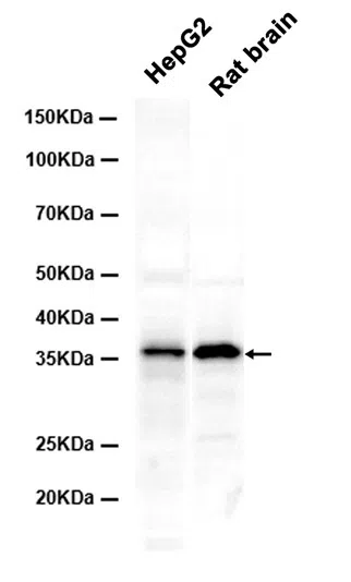 Apolipoprotein E Rabbit Monoclonal Antibody - Size: 50µl