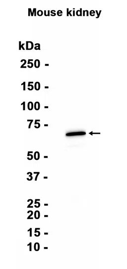 Dopamine Receptor D1 Rabbit Monoclonal Antibody - Size: 50µl