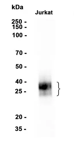 CD8 alpha Rabbit Monoclonal Antibody - Size: 50µl
