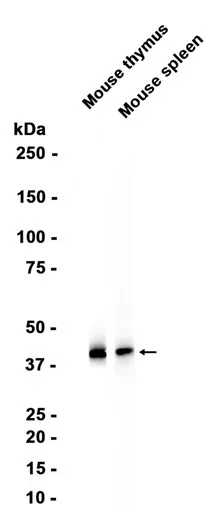 CD38 Rabbit Monoclonal Antibody - Size: 50µl