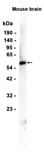 Zic2 Rabbit Monoclonal Antibody - Size: 100µl