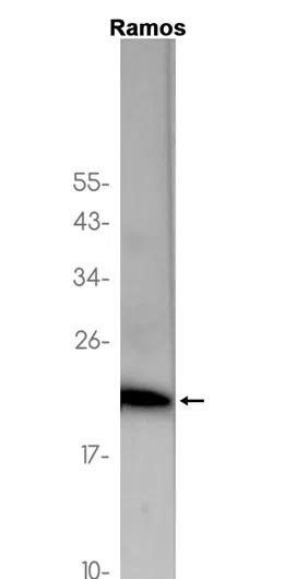 UBE2M Rabbit Monoclonal Antibody - Size: 50µl