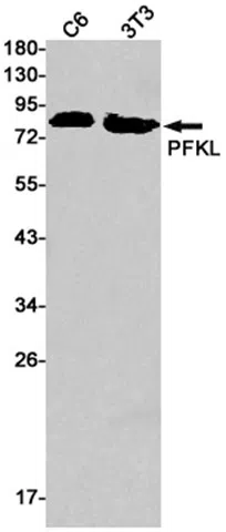PFKL Rabbit Monoclonal Antibody - Size: 100µl
