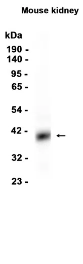 EpCAM Rabbit Monoclonal Antibody - Size: 50µl