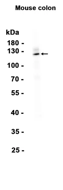 GC-C Rabbit Monoclonal Antibody - Size: 50µl