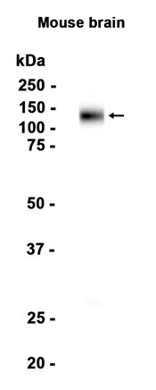 TrkA Rabbit Monoclonal Antibody - Size: 50µl
