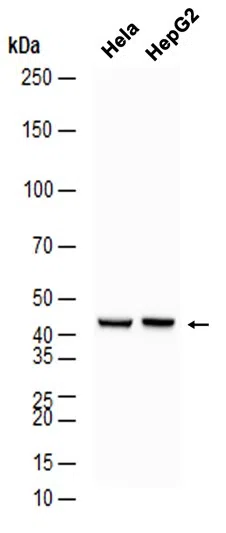 ICAD Rabbit Monoclonal Antibody - Size: 50µl