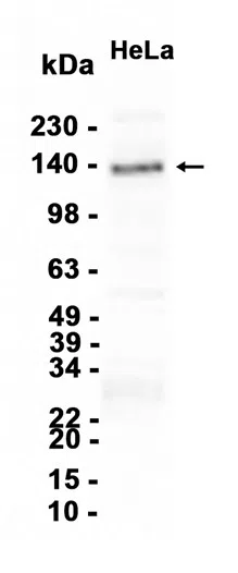 MDA5 Rabbit Monoclonal Antibody