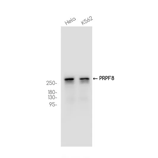 PRPF8 Rabbit Monoclonal Antibody - Size: 50µl