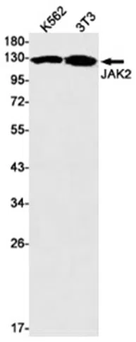 JAK2 Rabbit Monoclonal Antibody - Size: 100µl
