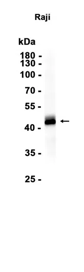 PAX5 Rabbit Monoclonal Antibody - Size: 50µl