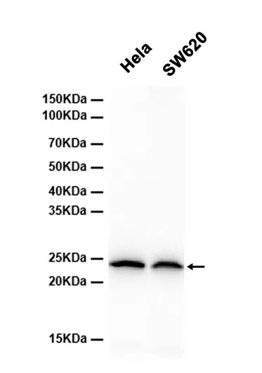 Proteasome 26S S10 Rabbit Monoclonal Antibody - Size: 50µl