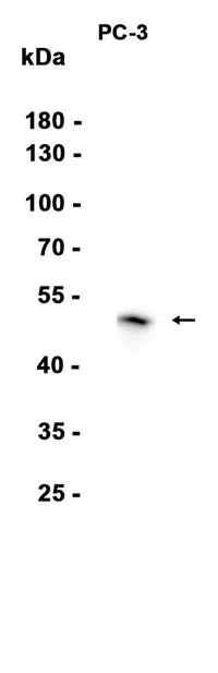 NDRG1 Rabbit Monoclonal Antibody - Size: 50µl