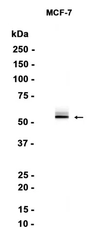 GBA Rabbit Monoclonal Antibody - Size: 100µl