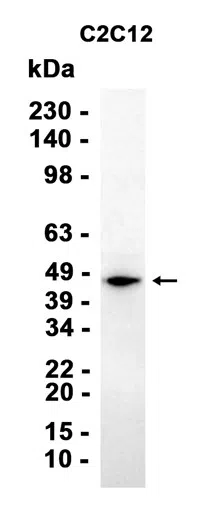 LMCD1 Rabbit Monoclonal Antibody - Size: 50µl