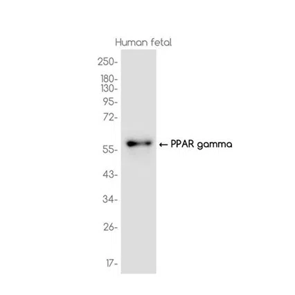 PPAR gamma Rabbit Monoclonal Antibody - Size: 50µl