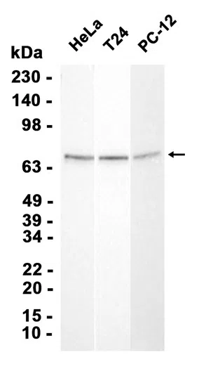 Optineurin Rabbit Monoclonal Antibody - Size: 50µl
