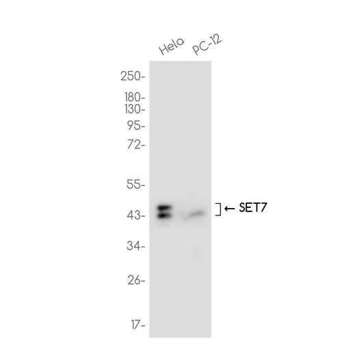 SET7 Rabbit Monoclonal Antibody - Size: 100µl