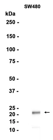 Lipocalin-2/NGAL Rabbit Monoclonal Antibody - Size: 50µl
