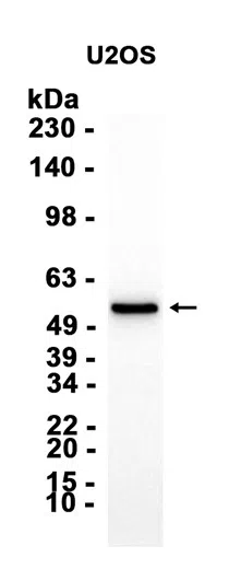 TMPRSS2 Rabbit Monoclonal Antibody - Size: 100µl