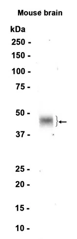 Tissue Factor Rabbit Monoclonal Antibody - Size: 50µl