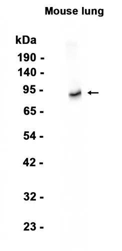 CD105 Rabbit Monoclonal Antibody