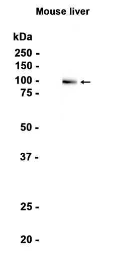 Plasminogen Rabbit Monoclonal Antibody - Size: 100µl