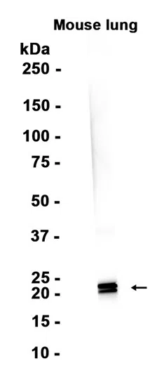 SP-C Rabbit Monoclonal Antibody - Size: 100µl