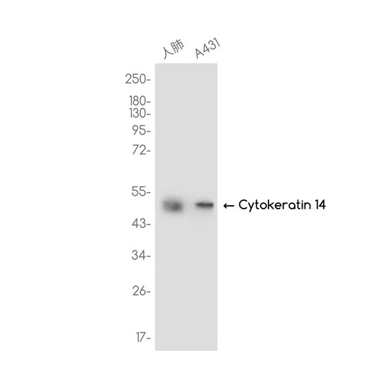 Cytokeratin 14 Rabbit Monoclonal Antibody - Size: 50µl
