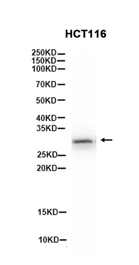 Bcl10 Rabbit Monoclonal Antibody - Size: 100µl