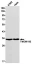 TMEM192 Rabbit Monoclonal Antibody - Size: 100µl